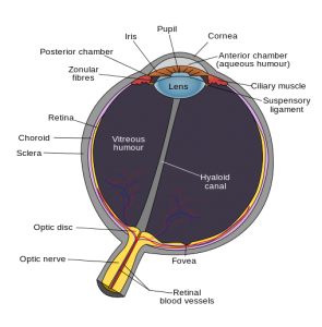 glaucoma