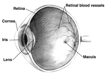 Amsler Grid - Retina Test - Retina Specialist - Buffalo New York - Back of  the Eye MD