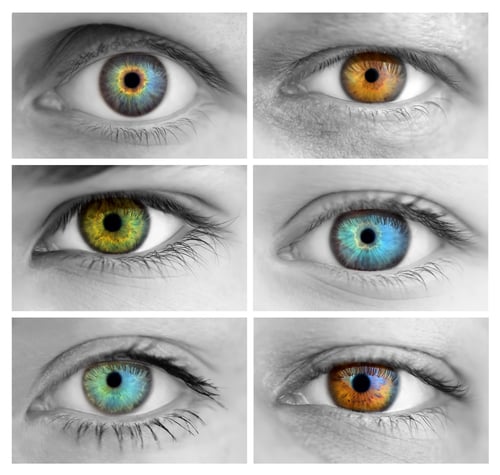 humans with two different colored eyes